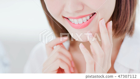 woman with retainer for teeth 47307112