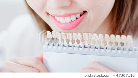 Teeth whiten concept 47307116