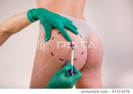 Surgeon drawing marks on female body before plastic operation, white background. Beautician touch 47313076