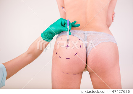 Surgeon drawing marks on female body before plastic operation, white background. Beautician touch 47427626