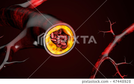 blood cells with plaque buildup of cholesterol blood cells with plaque buildup of cholesterol 47448928