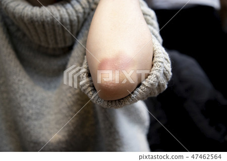 Elbow with biceps 47462564