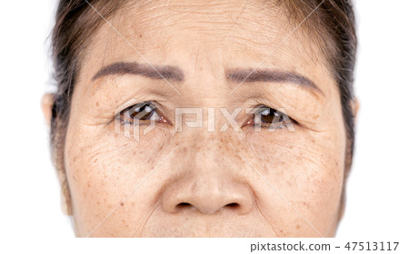 close up skin wrinkle old asian woman face 47513117