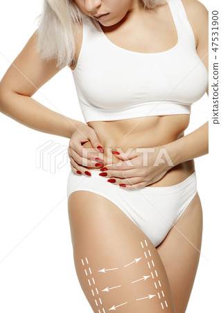 Female body with the drawing arrows. Fat lose, liposuction and cellulite removal concept Female body with the drawing arrows. Fat lose, liposuction and cellulite removal concept 47531900