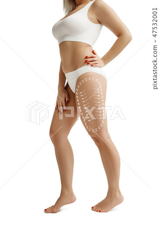 Female body with the drawing arrows. Fat lose, liposuction and cellulite removal concept Female body with the drawing arrows. Fat lose, liposuction and cellulite removal concept 47532001