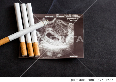 Burning, smoking cigarette in the picture of uzi pregnancy, pregnancy and smoking, cigarette 47604627