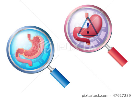 Stomach · loupe image 47617289