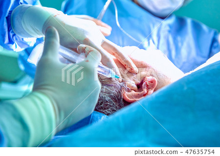 Chin reduction augmentation double chin removal plastic surgery cosmetic operation concept. Chin 47635754