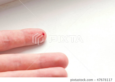 Cut on the finger of a man's hand. Blood flows. Cut on the finger of a man's hand. Blood flows. 47678117