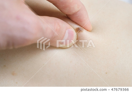Man's hand touches the mole on the woman's skin. Doctor medical screening. Close up hand and mole. Man's hand touches the mole on the woman's skin. Doctor medical screening. Close up hand and mole. 47679366