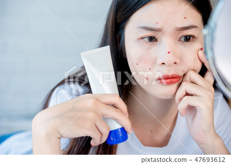 Asian teenage girl looking at acne problem on face 47693612