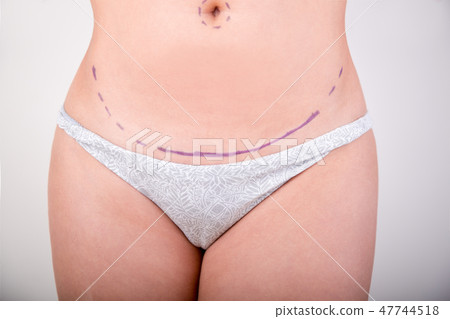 Surgeon drawing marks on female body before plastic operation, white background. Beautician touch 47744518