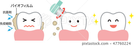Biofilm removal before after 47760224