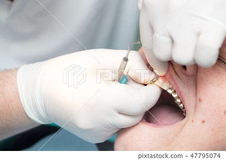 A dentist makes teeth to a woman A dentist makes teeth to a woman 47795074