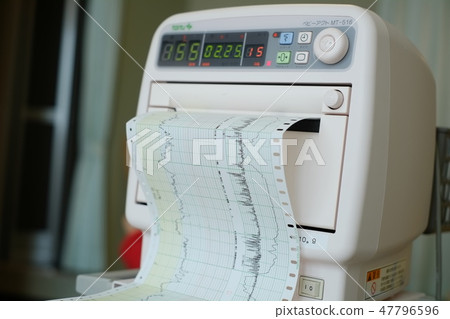 NST 臨產前監測波形 NST 臨產前監測波形 47796596
