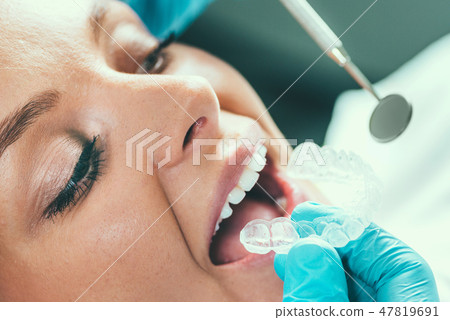 Tooth whitening procedure 47819691