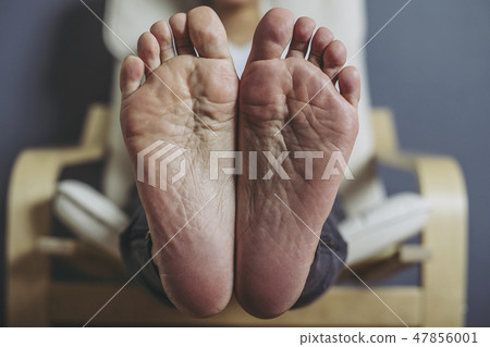 Wrinkled Soles Pics