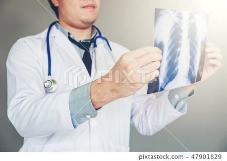 Doctor holding and checking chest x-ray film  47901829