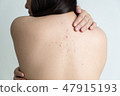 Woman with dermatology skin Dermatologist  47915193