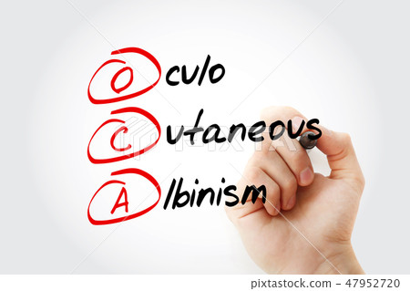 OCA - Oculo Cutaneous Albinism acronym OCA - Oculo Cutaneous Albinism acronym 47952720