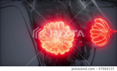 medically accurate illustration of an  mammary  47989135