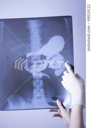 Medical xray spine hip scan 48019112