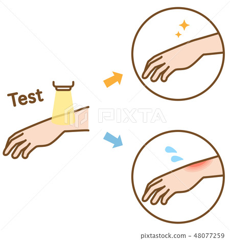 Illustration of light patch testing with arms 48077259