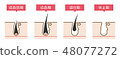 Hair cycle of hair removal Simple Cute explanatory illustration 48077272