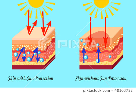 Two types of skin with and without sun protection, sunburn, vector illustration 48103752