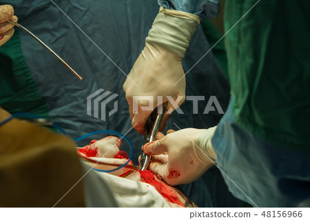 Operation of trepanation of the skull. 48156966