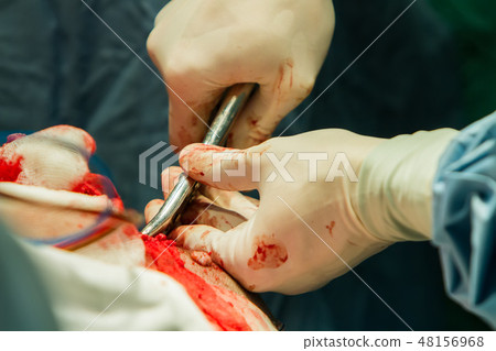 Operation of trepanation of the skull. 48156968