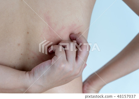 Woman Dermatologist examining birthmark of Woman Dermatologist examining birthmark of 48157037