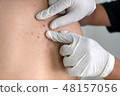 Woman Dermatologist examining birthmark of cal 48157056
