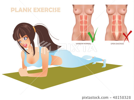 permitted and prohibited exercises for diastasis, Planck exercise permitted and prohibited exercises for diastasis, Planck exercise 48158328
