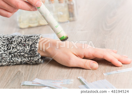 Therapist doing moxa treatment 48194524