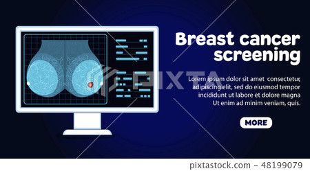 Breast cancer screening banner Breast cancer screening banner 48199079