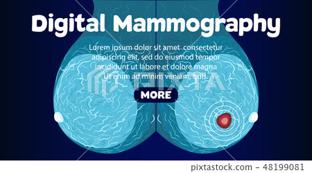 Digital Mammography banner 48199081