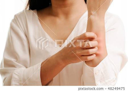 Women hand scratch the itch on arm, healthcare Women hand scratch the itch on arm, healthcare 48249475