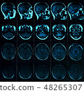 Magnetic resonance scan of the brain with skull 48265307