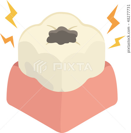 Carious tooth gums 48277731