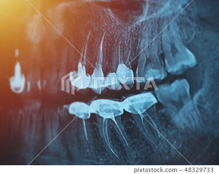 Dental xray for all teeth, side view 48329733