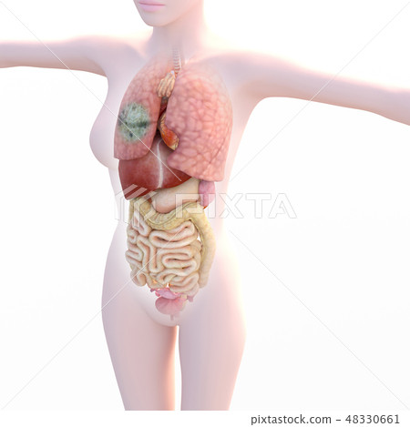 In-vivo image series (P1) lung lesion image perming3DCG illustration material In-vivo image series (P1) lung lesion image perming3DCG illustration material 48330661