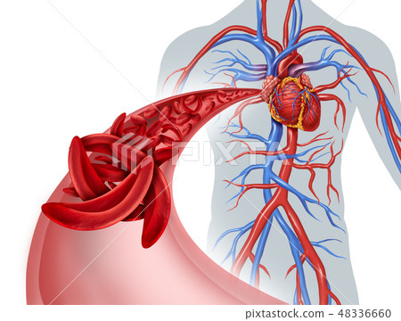 Sickle Cell Circulation Blockage 48336660