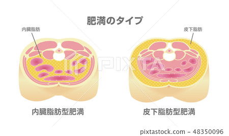 腹部截面圖“肥胖型”/內臟脂肪，皮下脂肪 48350096