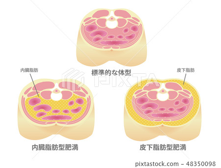 腹部截面圖“肥胖型”/標準型，內臟脂肪，皮下脂肪 48350098