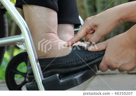 Elderly woman swollen feet press test Elderly woman swollen feet press test 48350207
