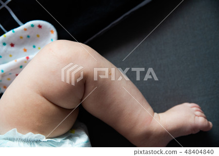 close up on atopic dermatitis, first symptoms 48404840