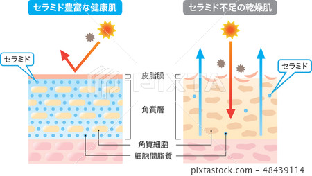 神經酰胺健康乾性皮膚乾燥-插圖素材 [48439114] - Pixta圖庫
