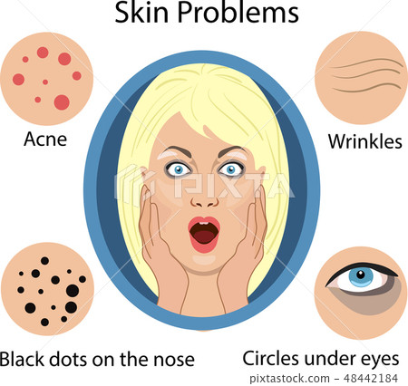 Female face skin problems. Vector illustration  48442184