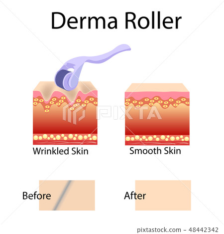 Mesorolling process, cell structure before after Mesorolling process, cell structure before after 48442342